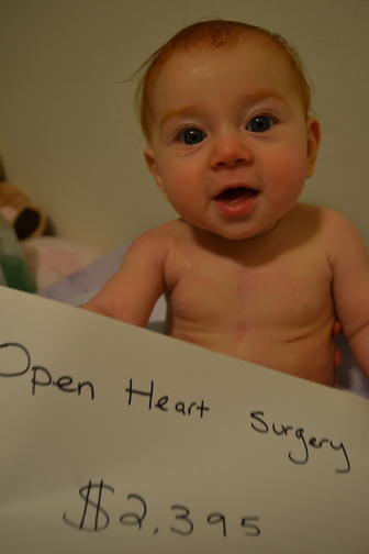 Open heart surgery: $428,903