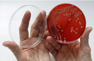 An employee displays MRSA bacteria inside a petri dish in a microbiological laboratory in Berlin