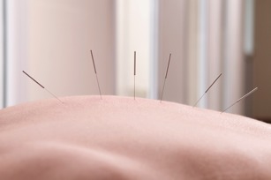 10. Acupuncture and Massage