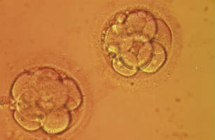 91494566a embryos