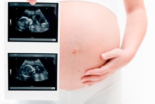 Ultrasound Guidelines May Wrongly Diagnose Miscarriage Time Com