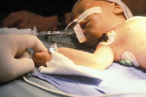 Baby anesthetized before heart surgery