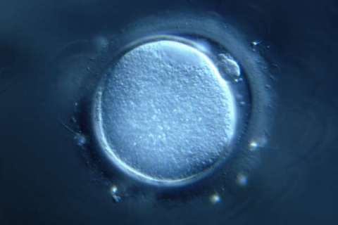 human egg cell