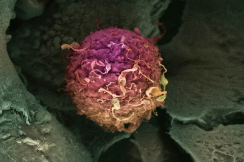 Breast Cancer cell