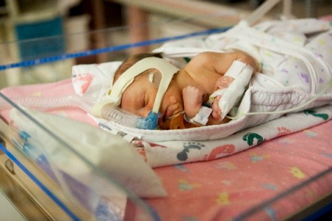 Newborn baby in NICU