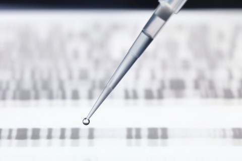 Pipetting DNA sample onto DNA sequencing gel