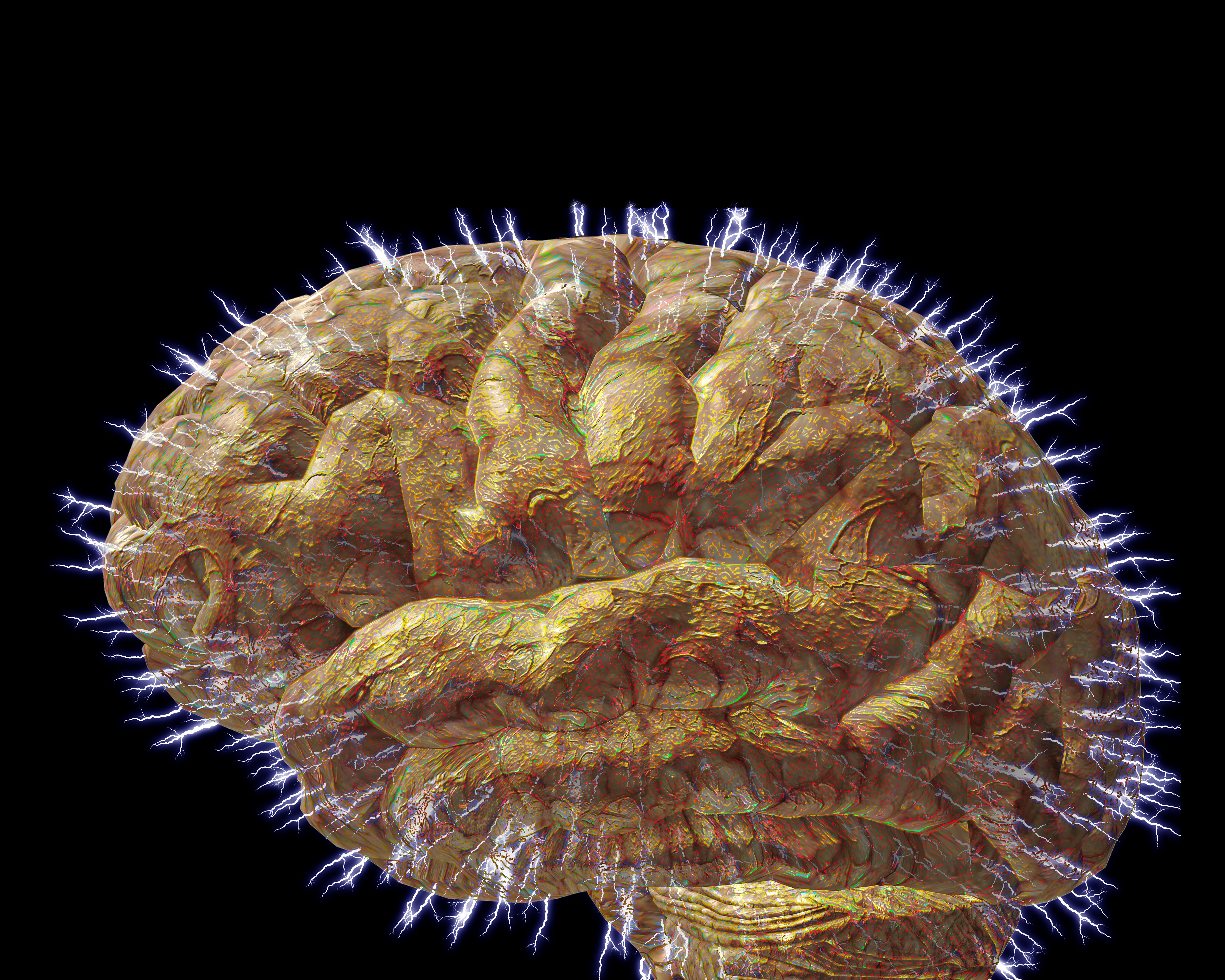 Unique Brain Pattern Could Predict Autism in Youngest Children