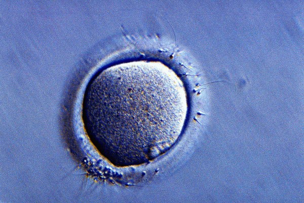 New Procedure to Induce Egg Growth Gives Fresh Hope to Infertile Women ...